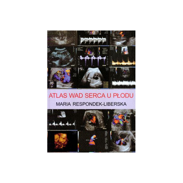 Atlas wad serca u płodu z cd