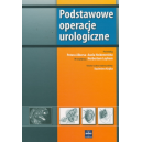 Podstawowe operacje urologiczne