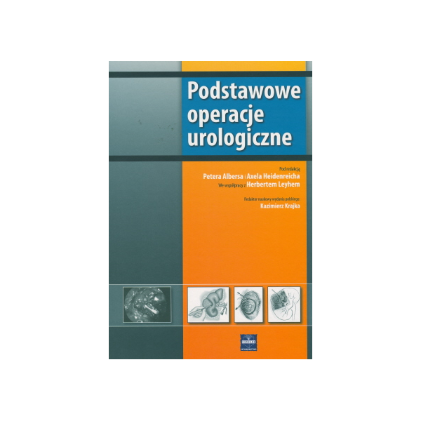 Podstawowe operacje urologiczne