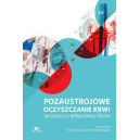 Pozaustrojowe oczyszcznie krwi na oddziale intensywnej terapii