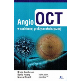 Angio-OCT w codziennej praktyce okulistycznej
