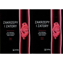 Zakrzepy i zatory t.1-2 