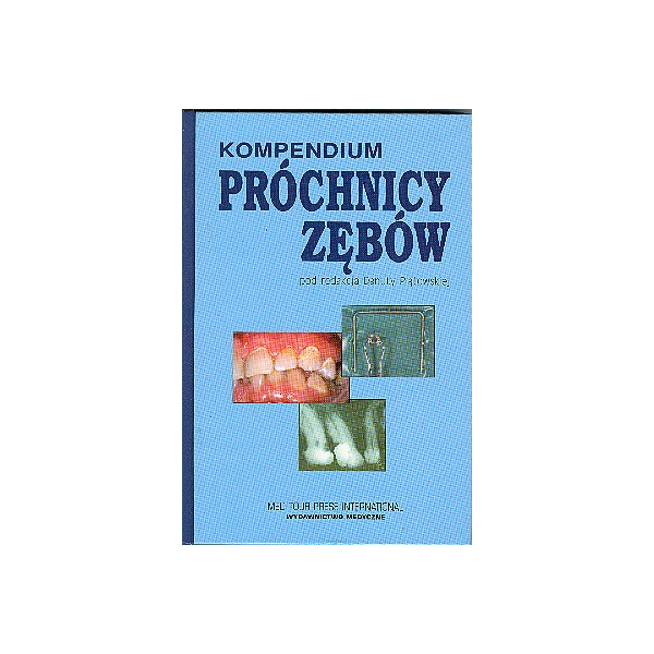 Kompendium próchnicy zębów