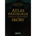 Atlas patologii złośliwych nowotworów skóry