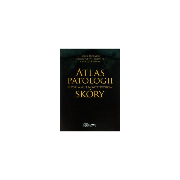 Atlas patologii złośliwych nowotworów skóry