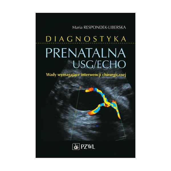 Diagnostyka prenatalna USG/ECHO 
Wady wymagające interwencji chirurgicznej