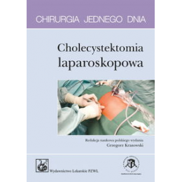 Cholecystektomia laparoskopowa