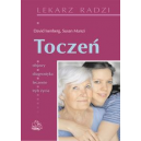 Toczeń Objawy, diagnostyka, leczenie, tryb życia