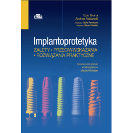 Implantoprotetyka Zalety przeciwwskazania rozwiązania praktyczne