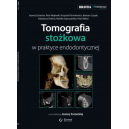 Tomografia stożkowa w praktyce endodontycznej