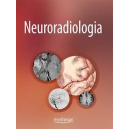 Neuroradiologia