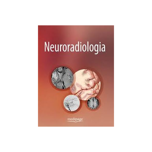 Neuroradiologia