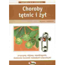 Choroby tętnic i żył przyczyny, objawy, zapobieganie, skuteczne leczenie metodami naturalnymi