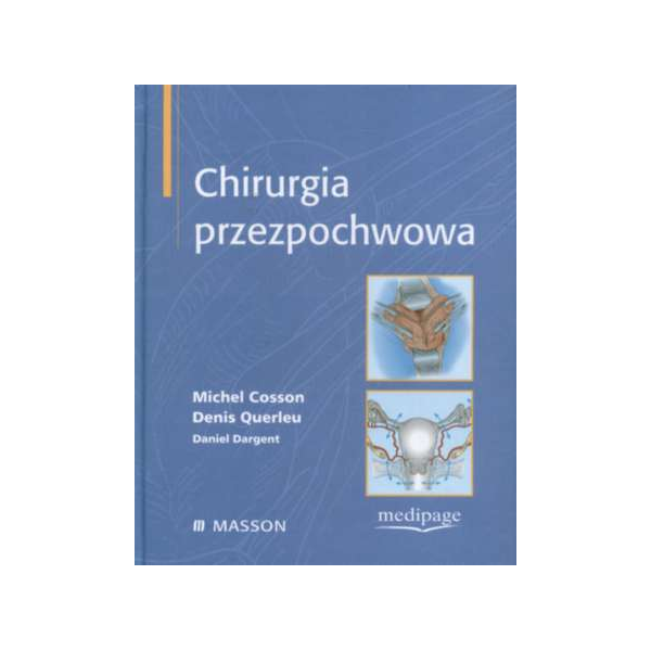 Chirurgia przezpochwowa