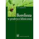 Borelioza w praktyce klinicznej