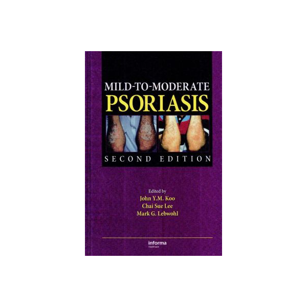 Mild-To-Moderate PSORIASIS 