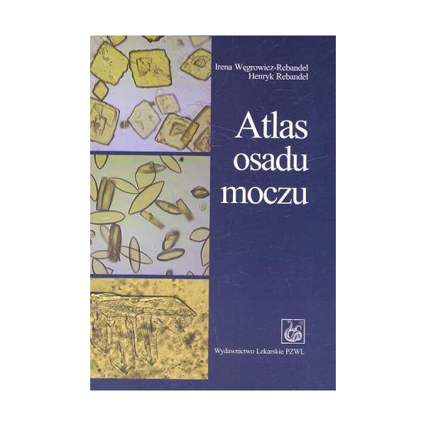 Atlas osadu moczu