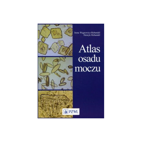 Atlas osadu moczu