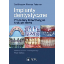 Implanty dentystyczne Procedury laboratoryjne krok po kroku