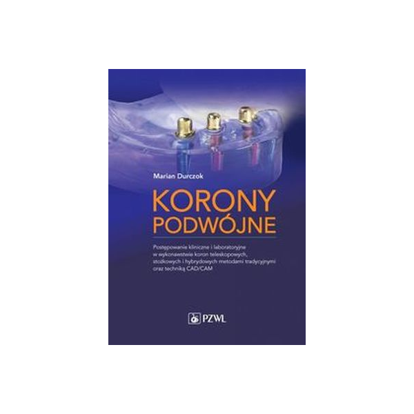 Korony podwójne postępowanie kliniczne i laboratoryjne w wykonawstwie koron teleskopowych,stożkowych i hybrydowych metodami trad