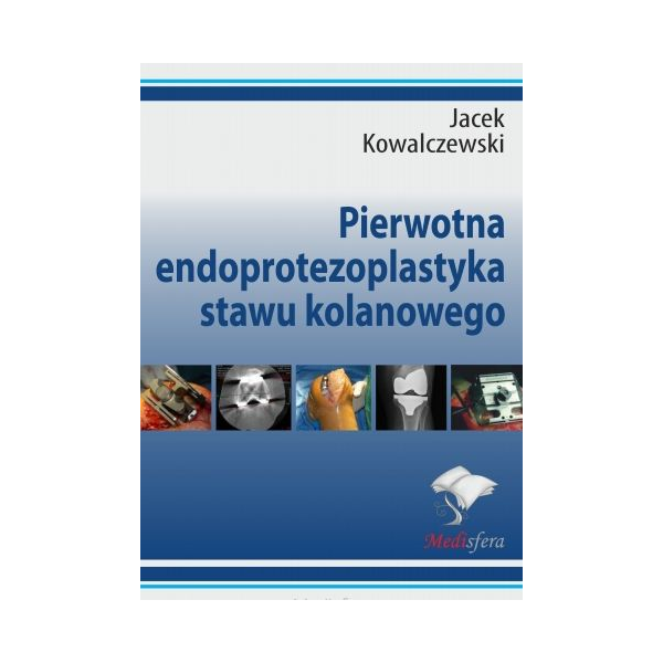 Pierwotna endoprotezoplastyka stawu kolanowego