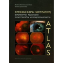 Czerniak błony naczyniowej
Atlas Diagnostyka różnicowa nowotworów wewnątrzgałkowych