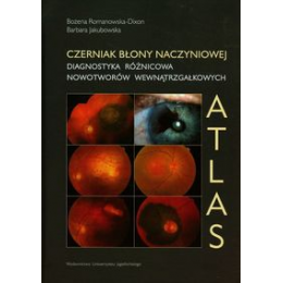 Czerniak błony naczyniowej
Atlas Diagnostyka różnicowa nowotworów wewnątrzgałkowych