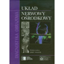 Diagnostyka obrazowa. Układ nerwowy ośrodkowy