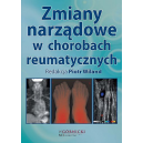 Zmiany narządowe w chorobach reumatycznych