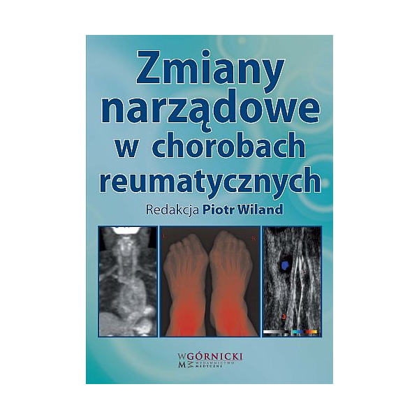 Zmiany narządowe w chorobach reumatycznych