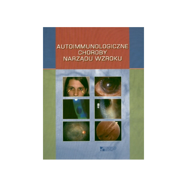 Autoimmunologiczne choroby narządu wzroku