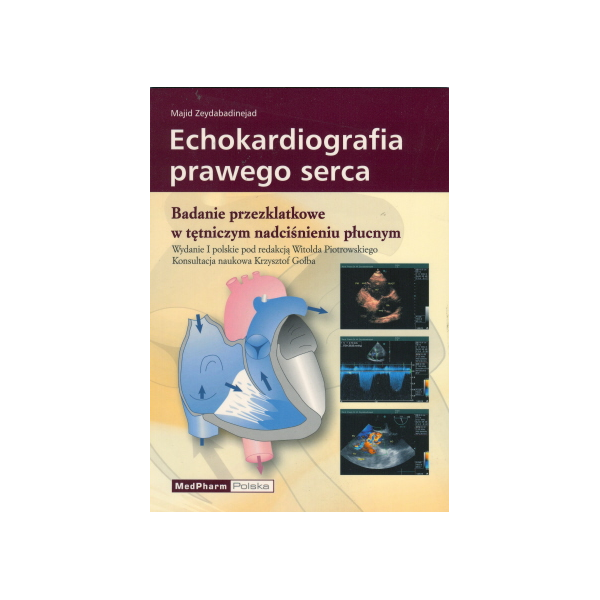 Echokardiografia prawego serca Badanie przezklatkowe w tętniczym nadciśnieniu płucnym