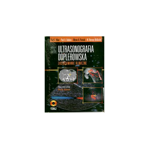 Ultrasonografia doplerowska. Zastosowanie kliniczne t.2 (z CD)