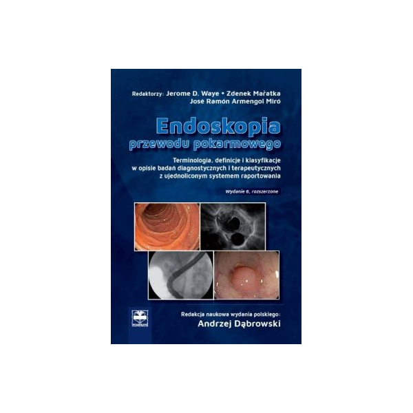 Endoskopia przewodu pokarmowego 
 Terminologia z definicjami i klasyfikacjami oraz terapia i ujednolicone opisy endoskopowe