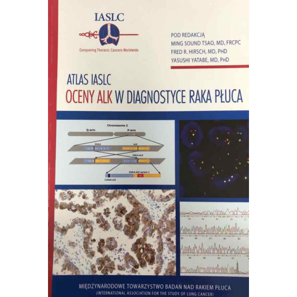 Atlas IASLC - oceny ALK w diagnostyce raka płuca