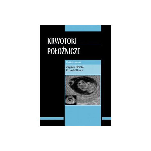 Krwotoki położnicze Krwotoki położnicze