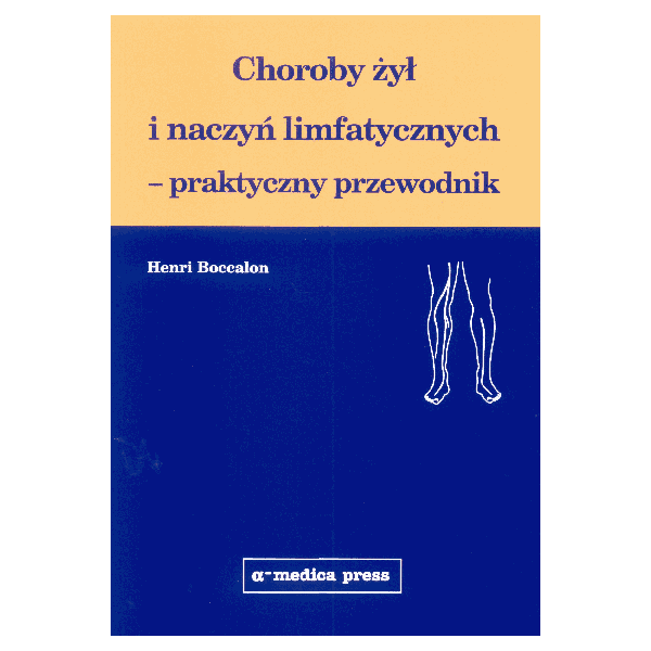 Choroby żył i naczyń limfatycznych - praktyczny przewodnik