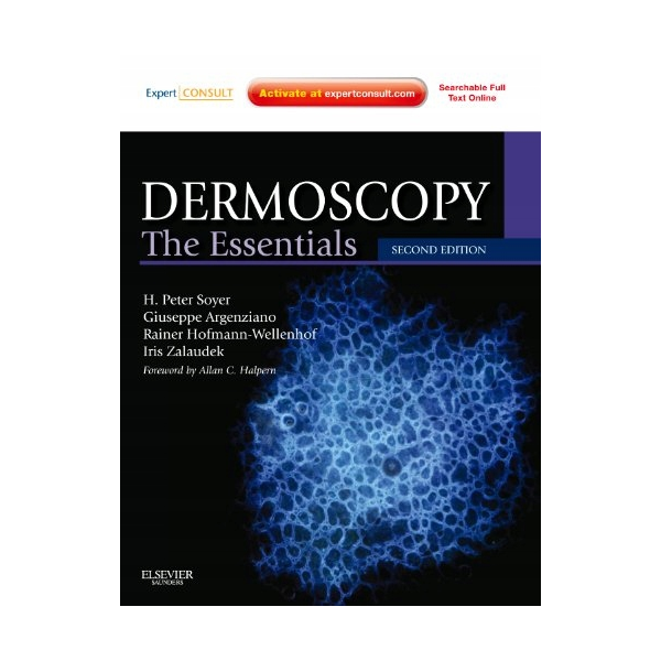 Dermatoscopy. The Essentials