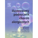 Ilustrowany podręcznik chorób alergicznych