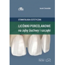 Licówki porcelanowe na zęby żuchwy i szczęki - Stomatologia estetyczna