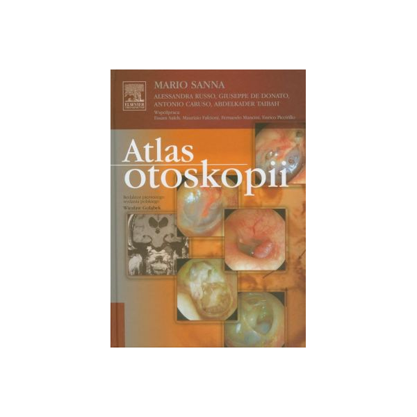 Atlas otoskopii