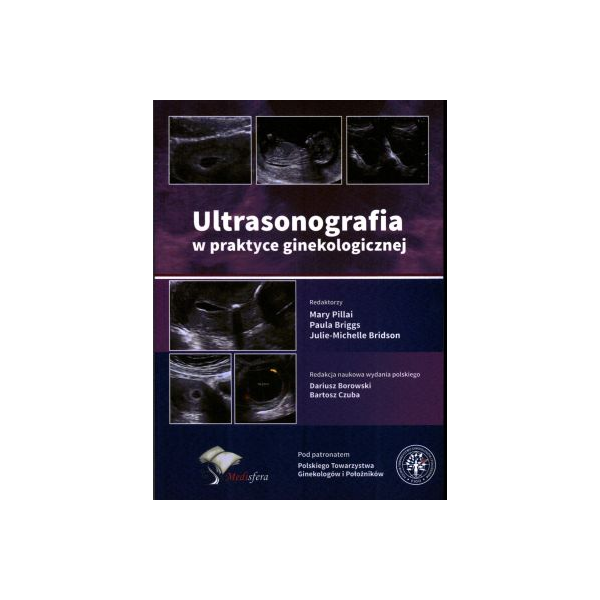 Ultrasonografia w praktyce ginekologicznej