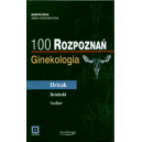 100 rozpoznań. Ginekologia