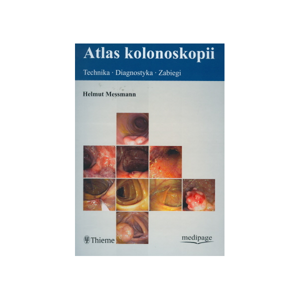 Atlas kolonoskopii Technika, diagnostyka, zabiegi