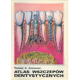 Atlas wszczepów dentystycznych