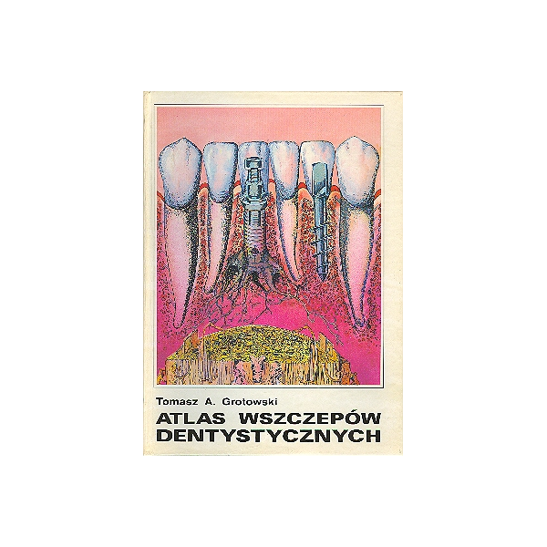 Atlas wszczepów dentystycznych