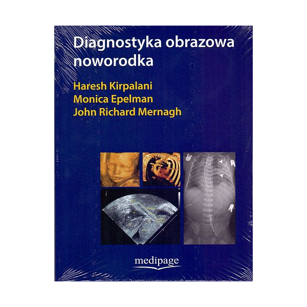 Diagnostyka obrazowa noworodka