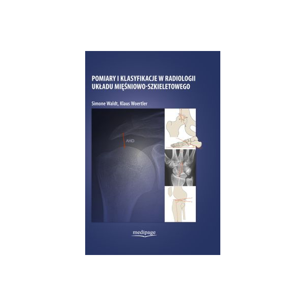 Pomiary i klasyfikacje w radiologii układu mięśniowo-szkieletowego