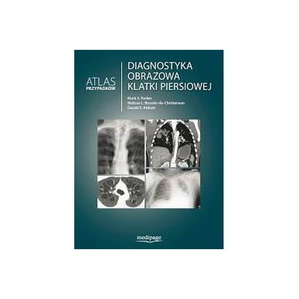 Diagnostyka obrazowa klatki piersiowej. Atlas przypadków klinicznych