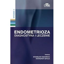 Endometrioza Diagnostyka i leczenie